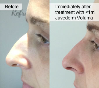 Before and after